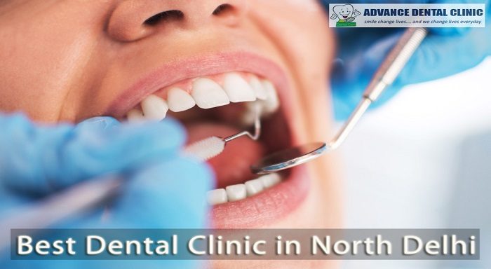 Best Dental Clinic in North Delhi